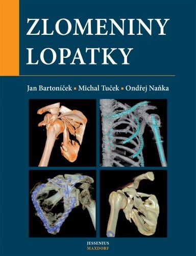 Obálka knihy Zlomeniny lopatky