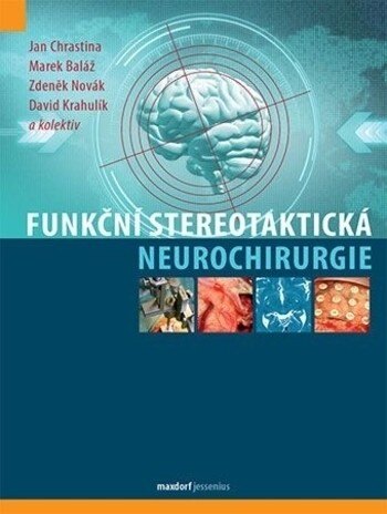 Obálka knihy Funkční stereotaktická neurochirurgie