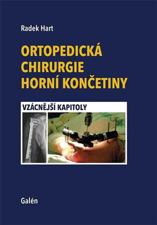 Obálka knihy Ortopedická chirurgie horní končetiny