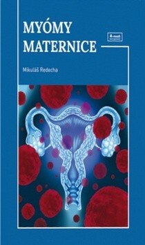 Obálka knihy Myómy maternice
