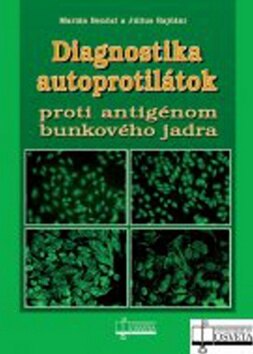 Obálka knihy Diagnostika autoprotilátok proti antigénom bunkového jadra