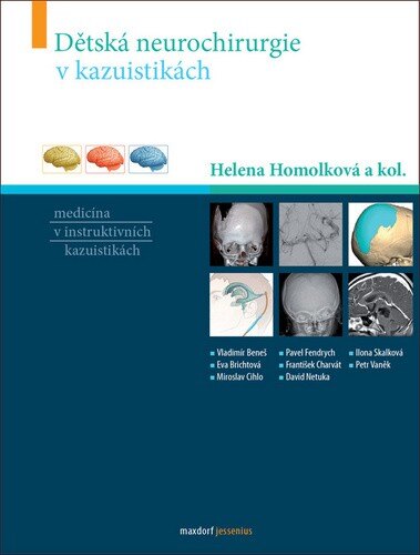 Obálka knihy Dětská neurochirurgie v kazuistikách