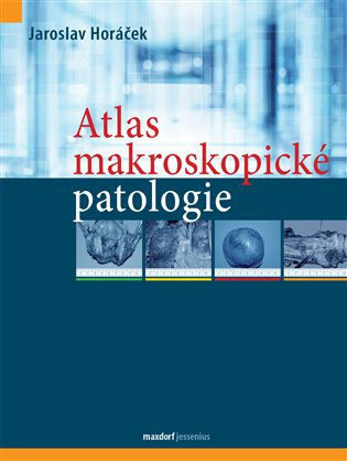 Obálka knihy Atlas makroskopické patologie