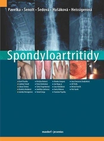 Obálka knihy Spondyloartritidy