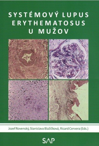 Obálka knihy Systemovy lupus erythematosus u muzov
