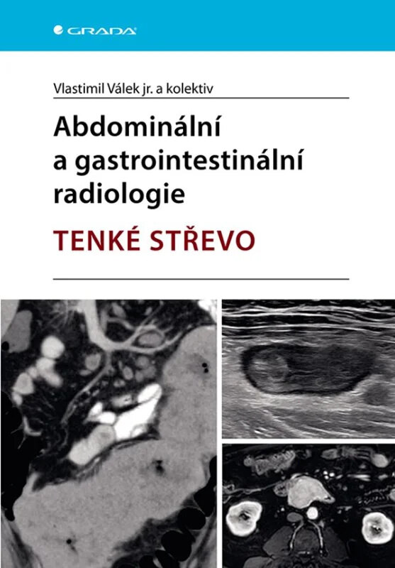 Obálka knihy Abdominální a gastrointestinální radiologie - Tenké střevo