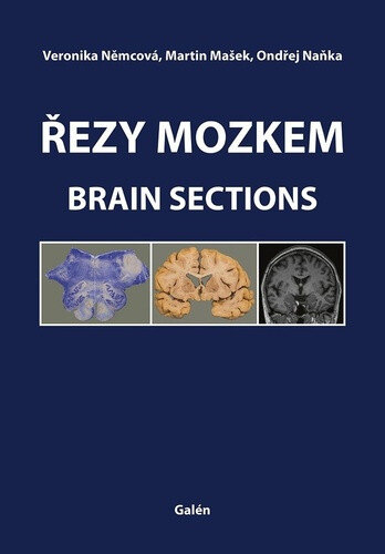 Obálka knihy Řezy mozkem