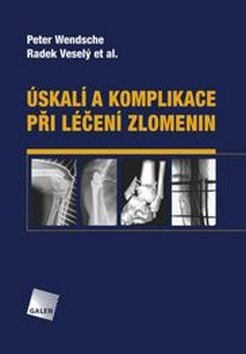 Obálka knihy Úskalí a komplikace při léčení zlomenin