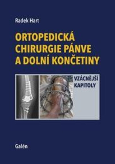 Obálka knihy Ortopedická chirurgie pánve a dolní končetiny