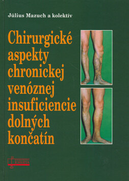 Obálka knihy Chirurgické aspekty chronickej venóznej insuficiencie dolných končatín (1. akosť)