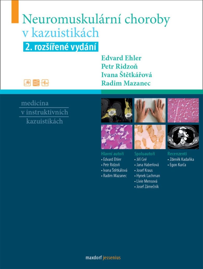 Obálka knihy Neuromuskulární choroby v kazuistikách