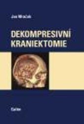 Obálka knihy Dekompresní kraniektomie
