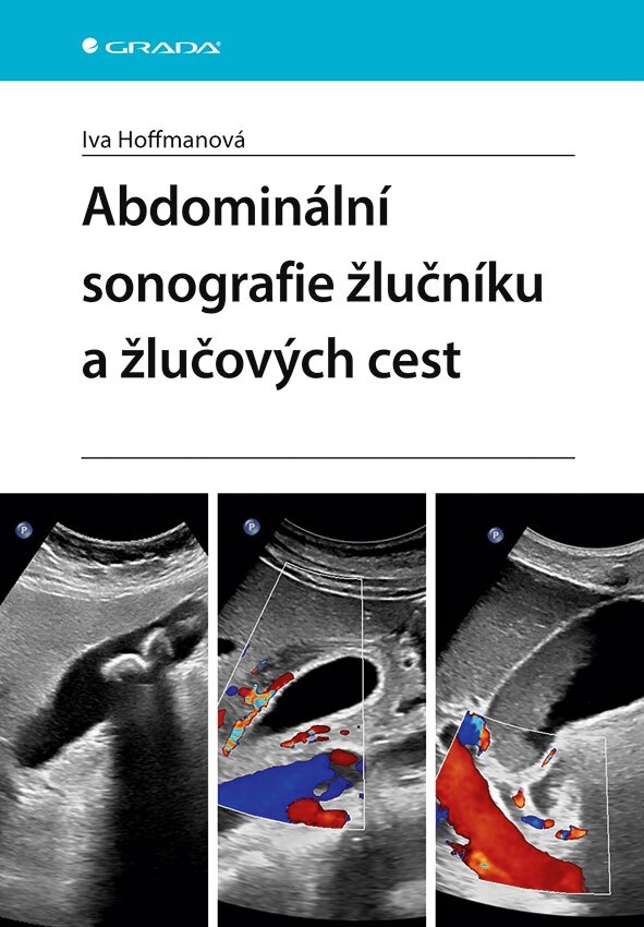 Obálka knihy Abdominální sonografie žlučníku a žlučových cest