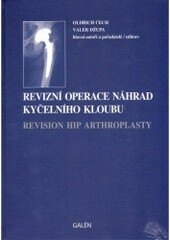 Obálka knihy Revizní operace náhrad kyčelního kloubu