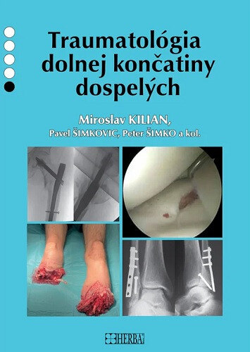Obálka knihy Traumatológia dolnej končatiny dospelých