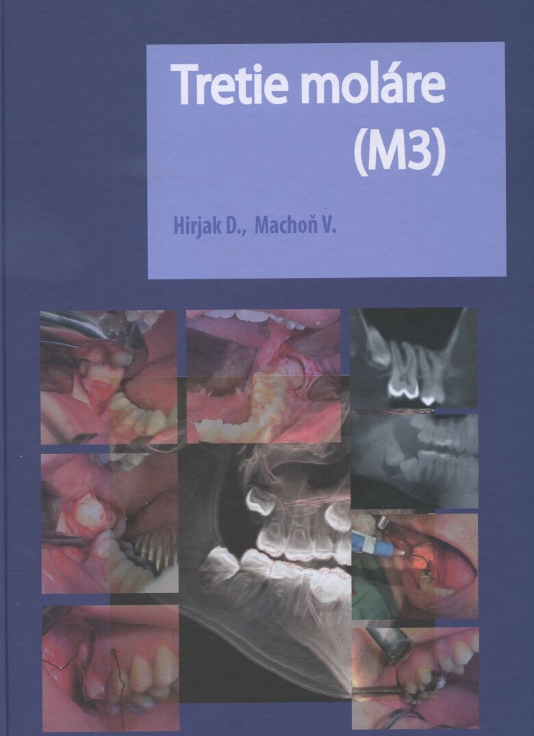 Obálka knihy Tretie moláre (M3)