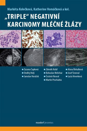 Obálka knihy ,,Triple“ negativní karcinomy mléčné žlázy