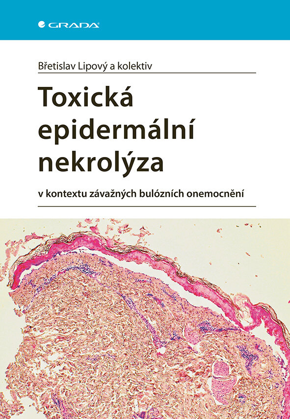 Obálka knihy Toxická epidermální nekrolýza