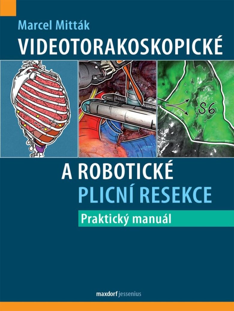 Obálka knihy Videotorakoskopické a robotické plicní resekce
