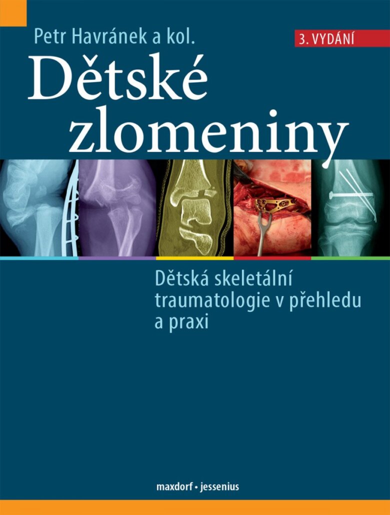 Obálka knihy Dětské zlomeniny - Dětská skeletální traumatologie v přehledu a praxi