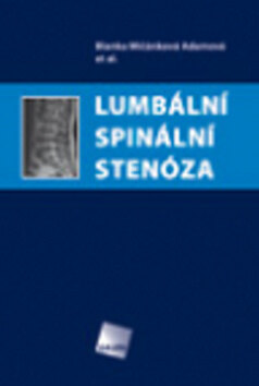 Obálka knihy Lumbální spinální stenóza