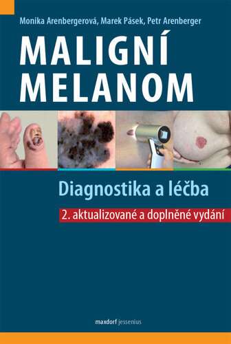 Obálka knihy Maligní melanom