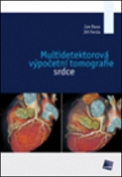 Obálka knihy Multidetektorová výpočetní tomografie srdce