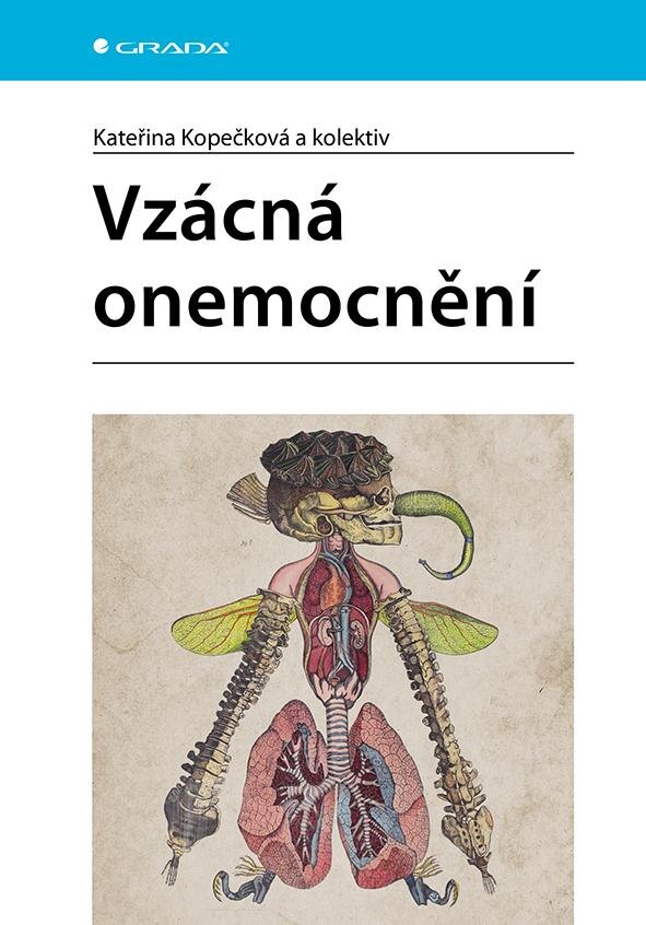 Obálka knihy Vzácná onemocnění
