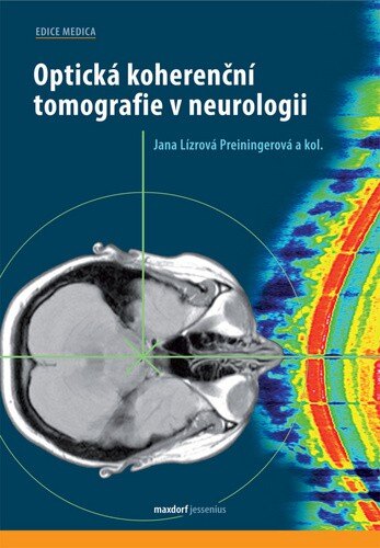 Obálka knihy Optická koherenční tomografie v neurologii