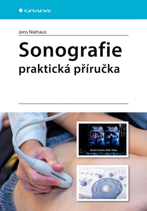 Obálka knihy Sonografie - praktická příručka