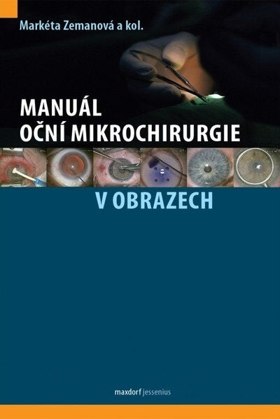 Obálka knihy Manuál oční mikrochirurgie v obrazech