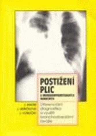Obálka knihy Postižení plic u imunokompromitovaných nemocných