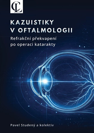 Obálka knihy Kazuistiky v oftalmologii