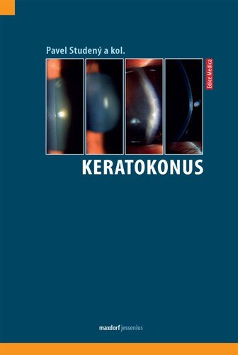 Obálka knihy Keratokonus