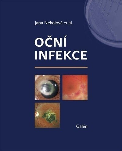 Obálka knihy Oční infekce