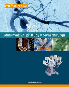 Obálka knihy Miniinvazivní přístupy v cévní chirurgií