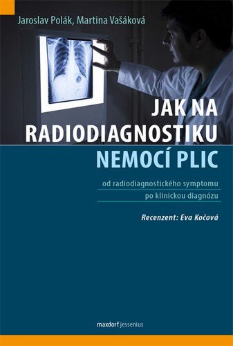 Obálka knihy Jak na radiodiagnostiku nemocí plic