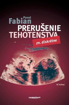Obálka knihy Prerušenie tehotenstva (1. akosť)