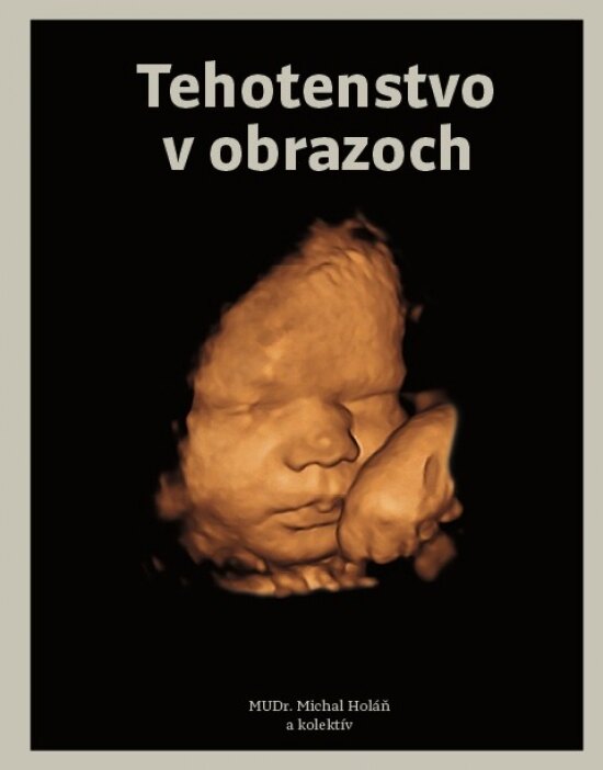 Obálka knihy Tehotenstvo v obrazoch