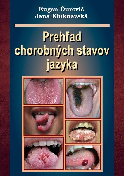 Obálka knihy Prehľad chorobných stavov jazyka
