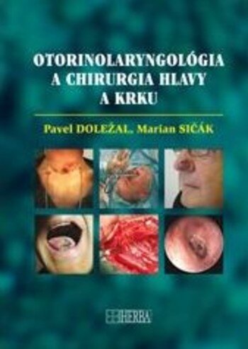 Obálka knihy Otorinolaryngológia a chirurgia hlavy a krku