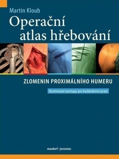 Obálka knihy Operační atlas hřebování zlomenin proximálního femuru
