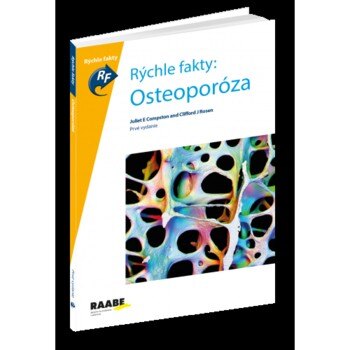 Obálka knihy Rýchle fakty: Osteoporóza