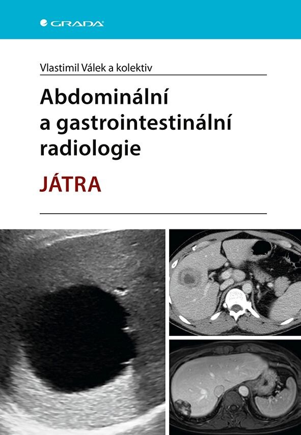 Obálka knihy Abdominální a gastrointestinální radiologie - Játra
