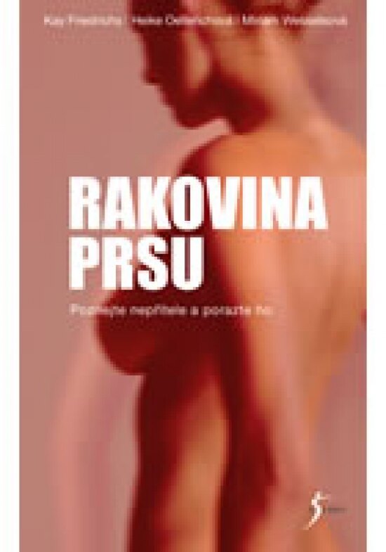 Obálka knihy Rakovina prsu