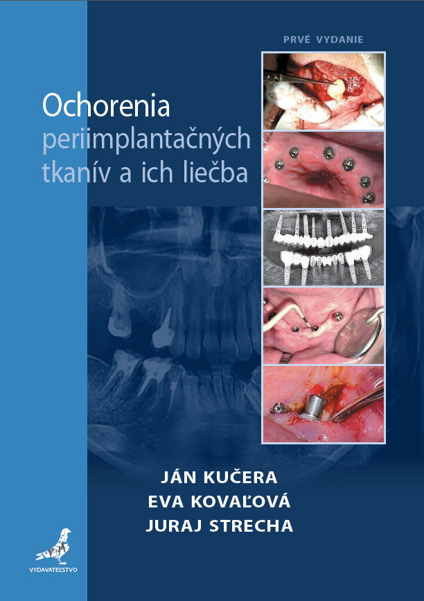 Obálka knihy Ochorenia periimplantačných tkanív a ich liečba