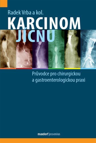 Obálka knihy Karcinom jícnu