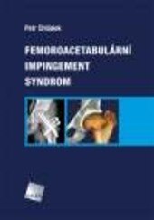 Obálka knihy Femoroacetabulární impingement syndrom