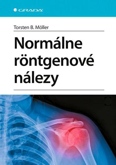 Obálka knihy Normálne röntgenové nálezy