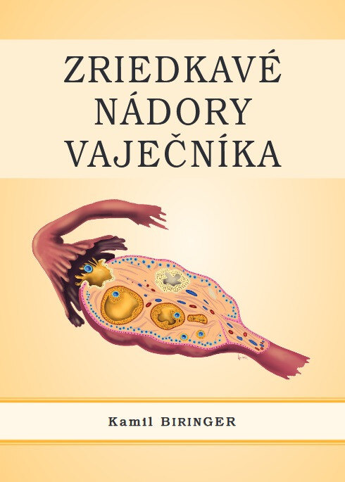 Obálka knihy Zriedkavé nádory vaječníka